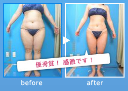 痩身・ダイエット
