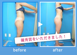 痩身・ダイエット