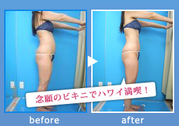 痩身・ダイエット