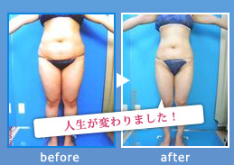 痩身・ダイエット