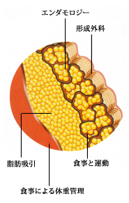 美容理学療法説明図