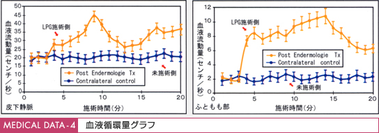 血液循環量グラフ