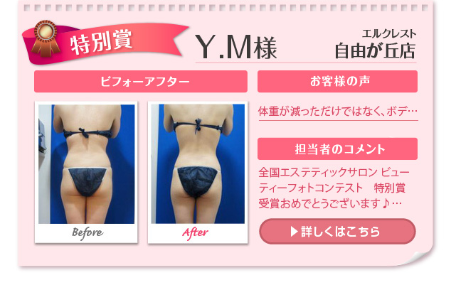 Y.M様 エルクレスト 自由が丘店 ビフォーアフター お客様の声 体重が減っただけではなく、ボディ... 担当者のコメント 全国エステティックサロン　ビューティーフォトコンテスト特別賞受賞おめでとうございます♪...