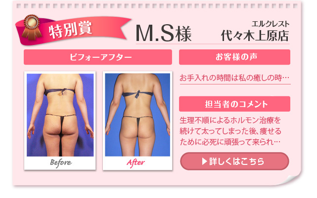 M.S様 エルクレスト 代々木上原店 ビフォーアフター お客様の声 お手入れの時間は私の癒しの時... 担当者のコメント 生理不順によるホルモン治療を続けて太ってしまった後、痩せるために必死に頑張って来られた...